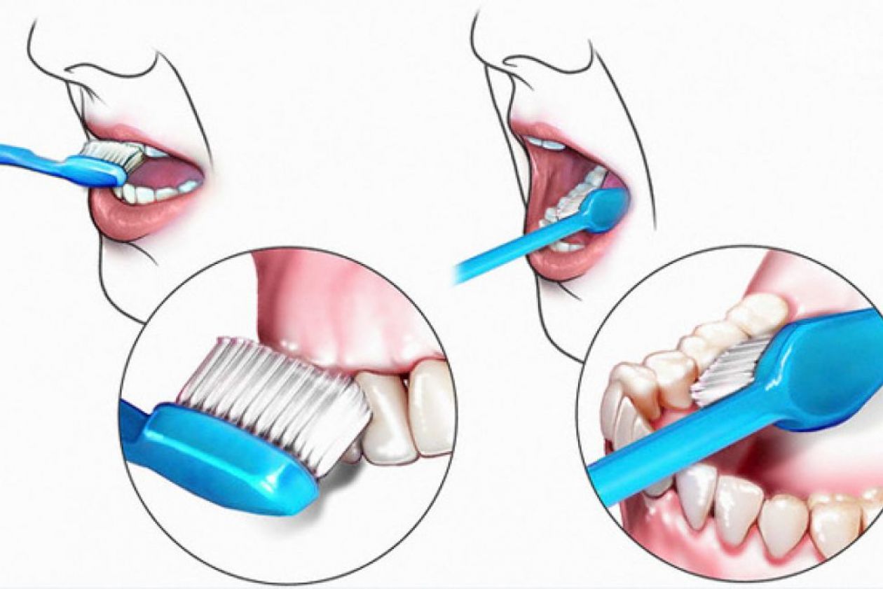 Уход за ртом тяжелобольного. Проф гигиена ротовой полости. Гигиеническая обработка полости рта. Метод чистки зубов электрической щетки. Алгоритм чистки зубов.