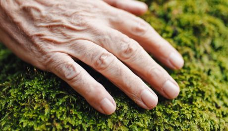 Grzybica paznokci – jak ją rozpoznać i leczyć?